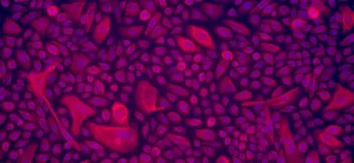 Fluorescence microscopy image showing a dense cluster of vaginal epithelial cells with blue-stained nuclei and red-stained cytoplasm, captured at 20X magnification.