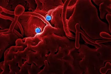 Bright blue balls lodge in a red, porous Middle East Respiratory syndrome coronavirus cluster.