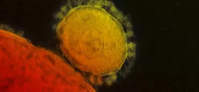 Grainy, large red and yellow spheres of Middle East respiratory syndrome coronavirus.