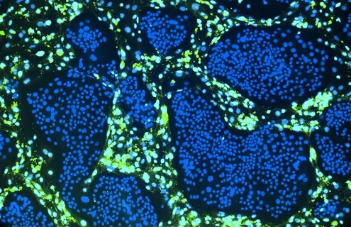 CRC-day5-488-dapi-day5-2.jpg