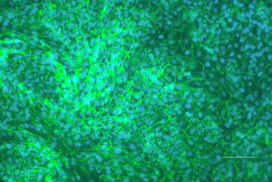 hTERT renal proximal tubular epithelial cells merged