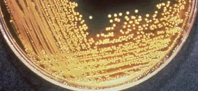 Tiny, yellow beads of Vibrio cholerae bacteria strung together with some spaces in between.