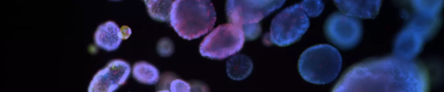 Fluorescent microscopy image showing multiple organoids in shades of blue, purple, and pink against a dark background, illustrating 3D cellular structures used in biomedical research.