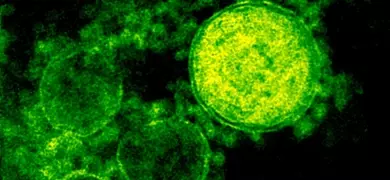 Digitally colorized transmission electron micrograph showing multiple spherical MERS-CoV virions in green, highlighting ultrastructural details of the viral particles against a black background.