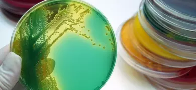 Microbiology, bacterial culture plates