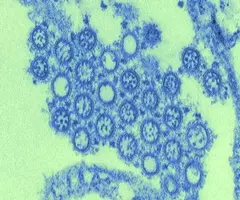 Small, round, and blue H1N1 flu virus.