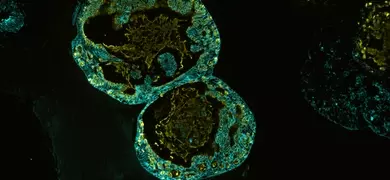Green ECAD organoid cells.