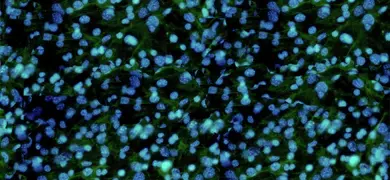 Blue and green fibroblast cells.