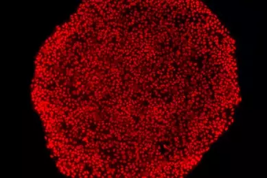 Red IPSC colony nanog cells.