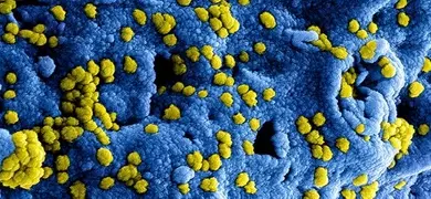 A highly magnified, digitally colorized scanning electron microscopic (SEM) image produced by the National Institute of Allergy and Infectious Diseases (NIAID), showing numerous yellow Middle East respiratory syndrome coronavirus (MERS-CoV) viral particles on the blue surface of a Vero E6 cell.