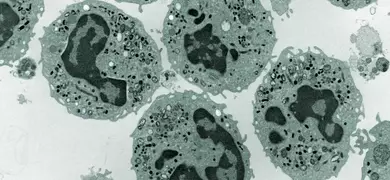 Greyscale electron microscope image showing multiple neutrophils, which are a type of immune cell. The cells have irregular shapes with darkly stained nuclei and various granules visible within the cytoplasm. The scale bar at the bottom left indicates a length of 2 micrometers.