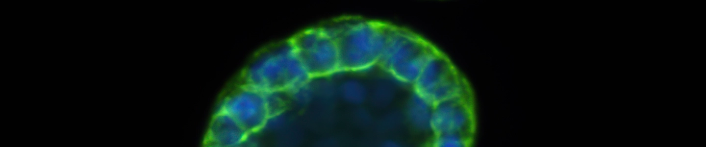 A high-magnification fluorescence microscopy image of two organoids against a black background. The primary organoid is a hollow, spherical structure composed of a single layer of cells with blue-stained nuclei and bright green-stained borders. A smaller, solid-looking organoid with similar staining is visible at the top of the frame.