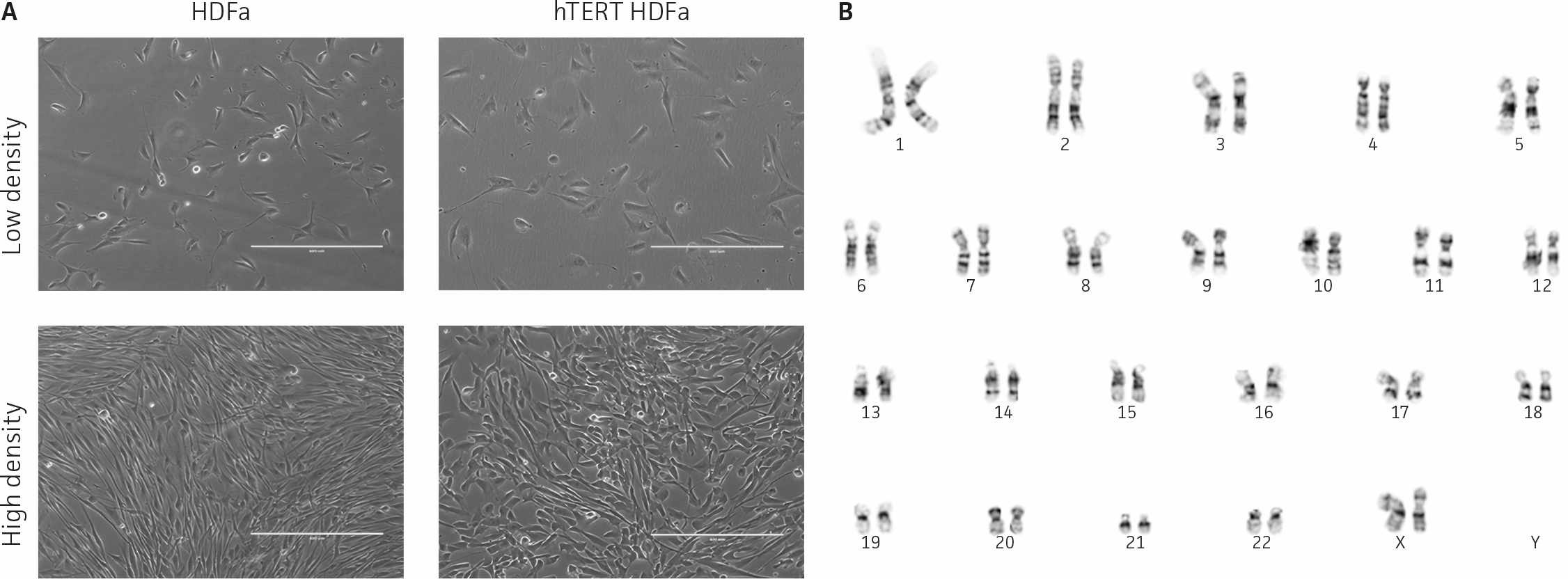 Microscopy images compare primary HDFa and hTERT HDFa cells at low and high densities, showing similar fibroblast morphology between the two cell types. A karyotype panel displays that hTERT HDFa cells retain a normal diploid chromosome complement.