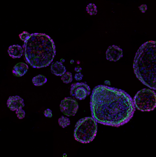 PDM-203 organoids DAPI, Phalloidin_2 (1).png