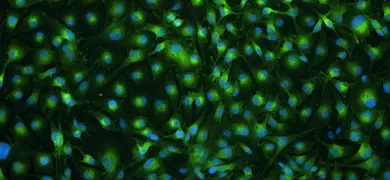 Fluorescent microscopy image showing hTERT-immortalized melanocyte neonatal Asian CRL-406 cells. The cells are stained with green and blue fluorescent dyes, highlighting the cell structures and nuclei respectively. The scale bar in the bottom right corner indicates 100 µm.