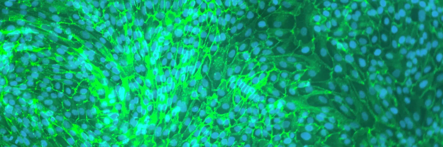 hTERT renal proximal tubular epithelial cells merged