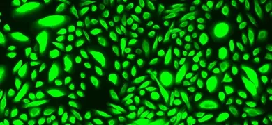 Green mammary epithelial cells.