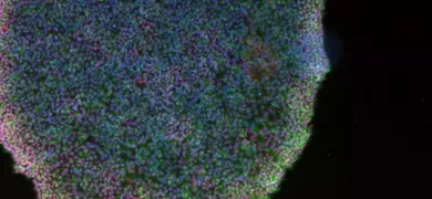 Fluorescent microscopy image of induced pluripotent stem cells showing a dense cluster with purple and green coloration against a black background.