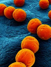 3d rendered orange balls of Streptococcus bacteria.