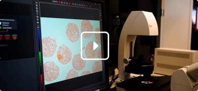 Image of cancer cells on computer screen