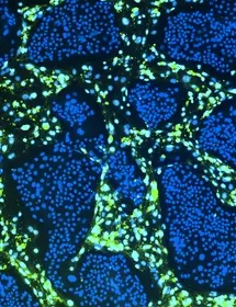  Green and blue conditionally reprogrammed organoid cells