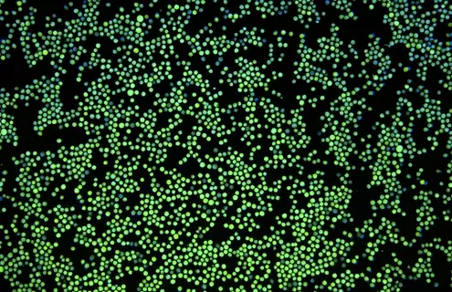 Green K562-GFP with nuclear stain.