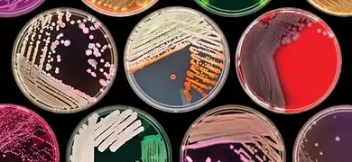 Multiple petri dishes in a variety of colors on a black background
