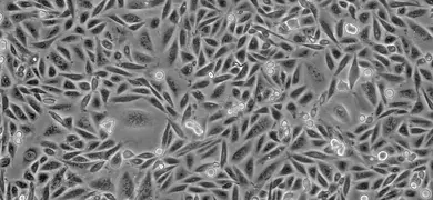 Hamster ovary epithelial cells.