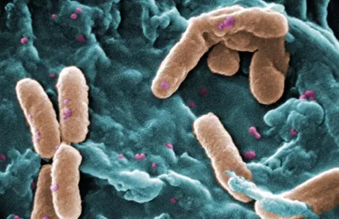 A scanning electron microscopic (SEM) image of a number of rod-shaped, Gram-negative, Pseudomonas aeruginosa bacteria.