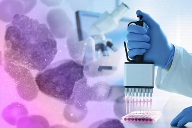 A scientist using a multichannel pipette to transfer liquid into a microtiter plate with monocytes background