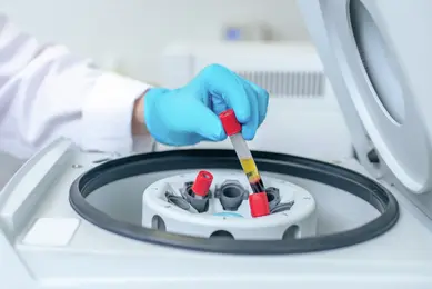 Close up of human hand putting the test tube to centrifuge