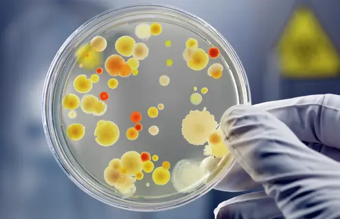 White-gloved fingers holding a petri dish containing yellow, orange, and red spheres of bacteria.