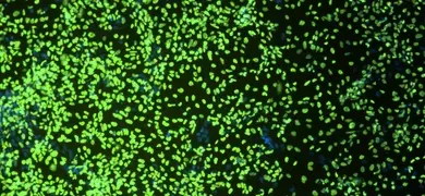 Green organoid cells.