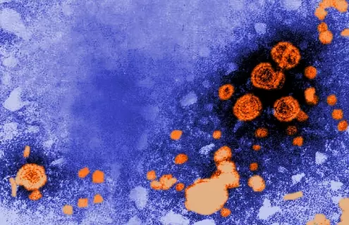 Transmission electron microscopic (TEM) image revealed the presence of hepatitis B virus (HBV) particles (orange). The round virions, which measure 42nm in diameter, are known as Dane particles.