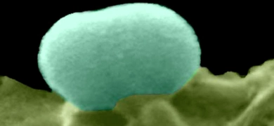 Grainy, light blue sphere of Eschirichia coli bacterium, Dr Paul Dean, Newcastle University
