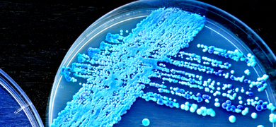 Petri dish of teal blue yeast in a crisscross of round beads.