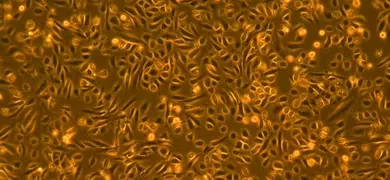 Small, yellow and brown renal cortical cells.