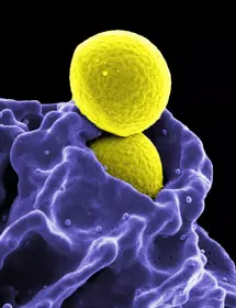 Yellow spheres of methicillin-resistant staphylococcus aureus.