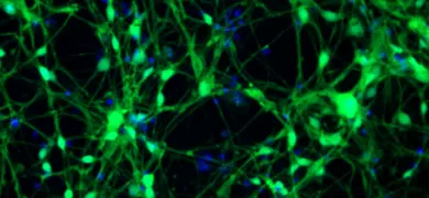 String-like web of fluorescent green and blue organic anion transporter proteins.