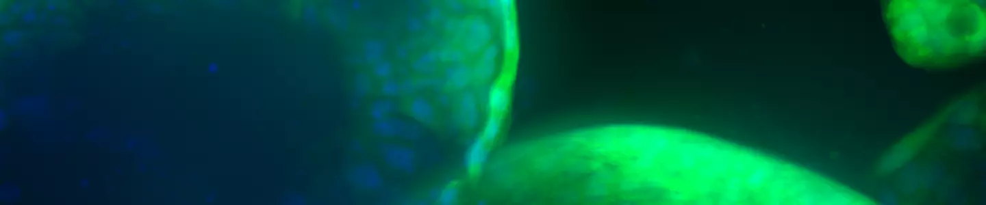 Green organoid from Sanger 10172017