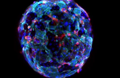 A fluorescence microscopy image shows a spherical organoid composed of tightly packed cells stained with cyan cytoskeletal markers, blue nuclei, and scattered red‑stained cells. The organoid’s surface and internal structure are highlighted in high detail against a black background.
