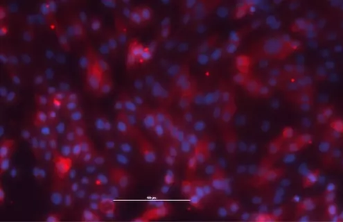 Red and purple renal proximal tubular epithelial cells.