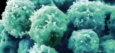 Green embryonic IPS stem cells.