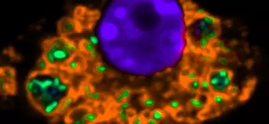 A round, fluorescent purple sphere is surrounded by a cluster of fluorescent orange and lime green elements against a black background.