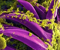 Purple, banana-shaped Yersinia pestis bacteria with yellow-green growths.