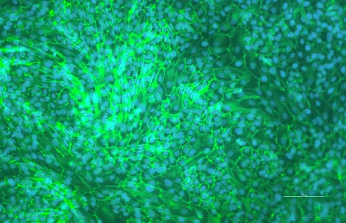 hTERT renal proximal tubular epithelial cells merged