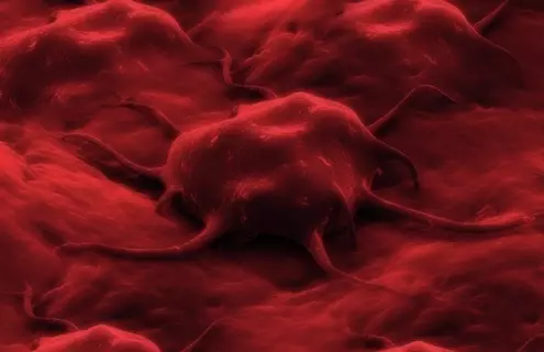 Uncontrolled cancer cell growth.