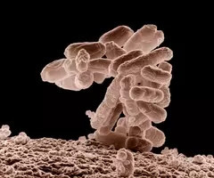 Brown and white, rod-shaped Escherichia coli bacteria cluster.