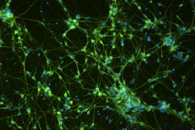 ACS -5003 Dopaminergic Diff  Tuj1  DAPI.jpg