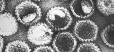 This negative-stained transmission electron microscopic (TEM) image revealed the presence of numerous herpes simplex virions, members of the Herpesviridae virus family. There are two strains of herpes simplex virus, HSV-1, which is responsible for cold sores, and HSV-2, which is responsible for genital herpes. At the core of its icosahedral proteinaceous capsid, HSV contains a double-stranded DNA linear genome.
